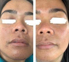 Green Tea Deep Cleansing Mask (Buy 1 Get 1 Free) photo review