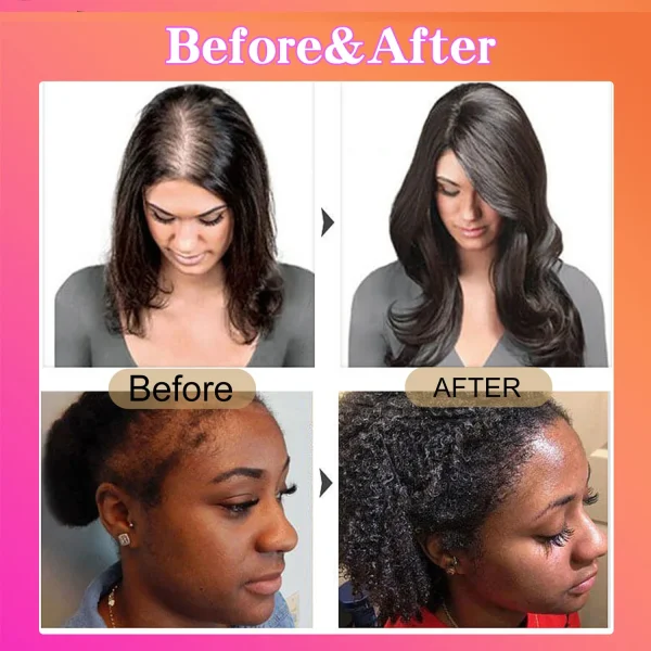 BOTANIX - Batana Natural Hair Growth Oil (For Men And women) | Buy 1 Get 1 Free 🎁 - Image 4
